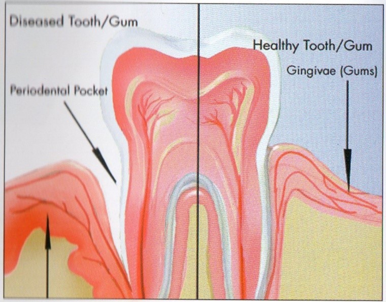 Diabetes Deep Dental Clinic And OPG Centre
